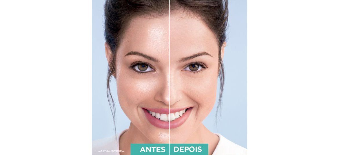 Antes E Depois 2